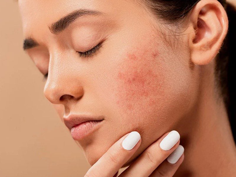 Nggak Usah Sok-sokan Pakai 10 Step Korean Skincare Routine kalau CTMP Aja Belum Khatam! terminal mojok
